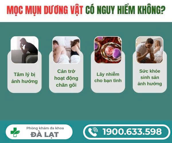 Hình ảnh minh họa